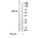 Western blot - TBX18 Antibody from Signalway Antibody (35087) - Antibodies.com