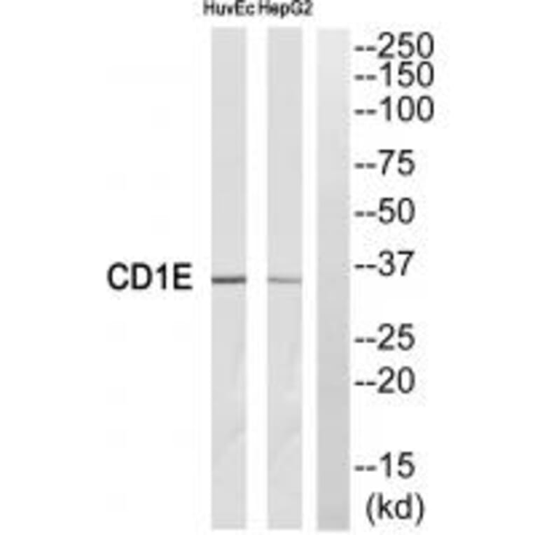 Western blot - CD1E Antibody from Signalway Antibody (35089) - Antibodies.com