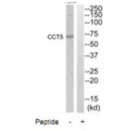 Western blot - CCT5 Antibody from Signalway Antibody (35090) - Antibodies.com