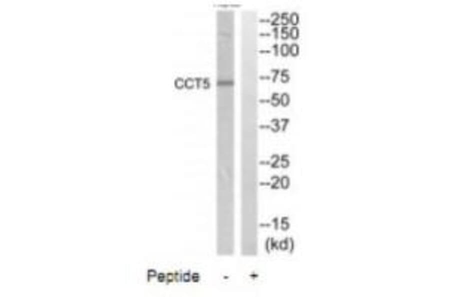 Western blot - CCT5 Antibody from Signalway Antibody (35090) - Antibodies.com