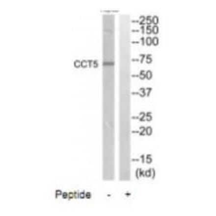 Western blot - CCT5 Antibody from Signalway Antibody (35090) - Antibodies.com