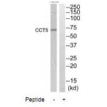 Western blot - CCT5 Antibody from Signalway Antibody (35090) - Antibodies.com