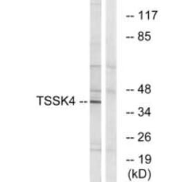 Western blot - TSSK4 Antibody from Signalway Antibody (35093) - Antibodies.com