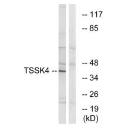 Western blot - TSSK4 Antibody from Signalway Antibody (35093) - Antibodies.com
