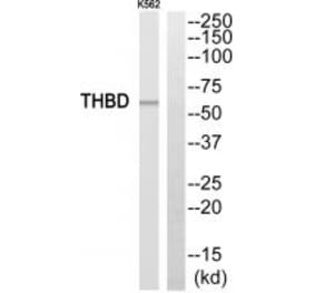 Western blot - THBD Antibody from Signalway Antibody (35094) - Antibodies.com