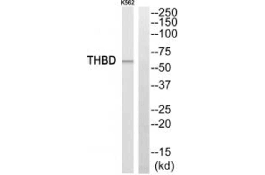 Western blot - THBD Antibody from Signalway Antibody (35094) - Antibodies.com