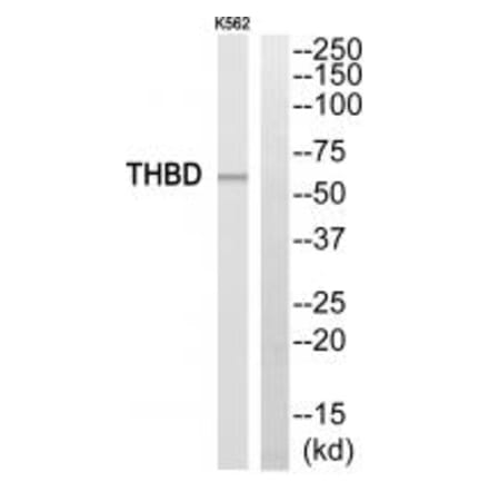 Western blot - THBD Antibody from Signalway Antibody (35094) - Antibodies.com