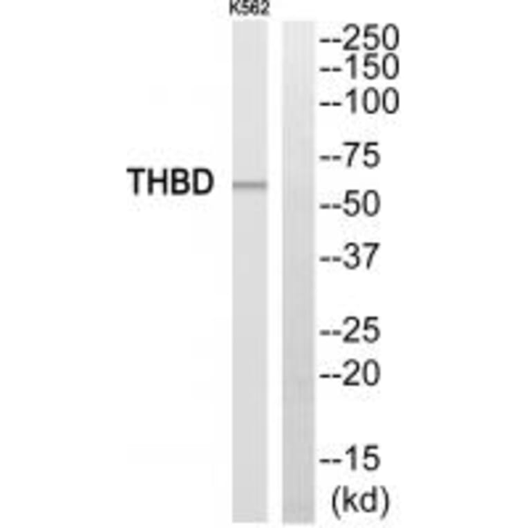 Western blot - THBD Antibody from Signalway Antibody (35094) - Antibodies.com
