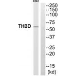 Western blot - THBD Antibody from Signalway Antibody (35094) - Antibodies.com