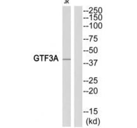 Western blot - GTF3A Antibody from Signalway Antibody (35104) - Antibodies.com