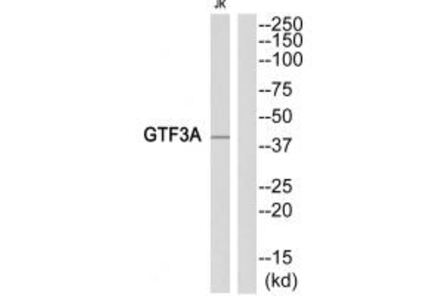 Western blot - GTF3A Antibody from Signalway Antibody (35104) - Antibodies.com