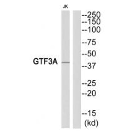 Western blot - GTF3A Antibody from Signalway Antibody (35104) - Antibodies.com