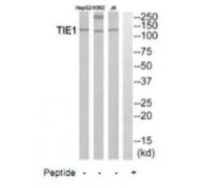 Western blot - TIE1 Antibody from Signalway Antibody (35111) - Antibodies.com