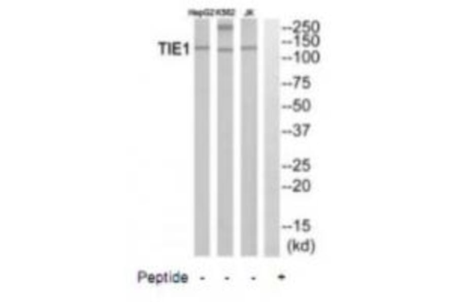 Western blot - TIE1 Antibody from Signalway Antibody (35111) - Antibodies.com