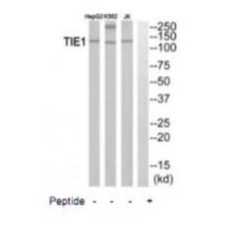 Western blot - TIE1 Antibody from Signalway Antibody (35111) - Antibodies.com