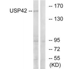 Western blot - USP42 Antibody from Signalway Antibody (35123) - Antibodies.com