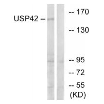 Western blot - USP42 Antibody from Signalway Antibody (35123) - Antibodies.com