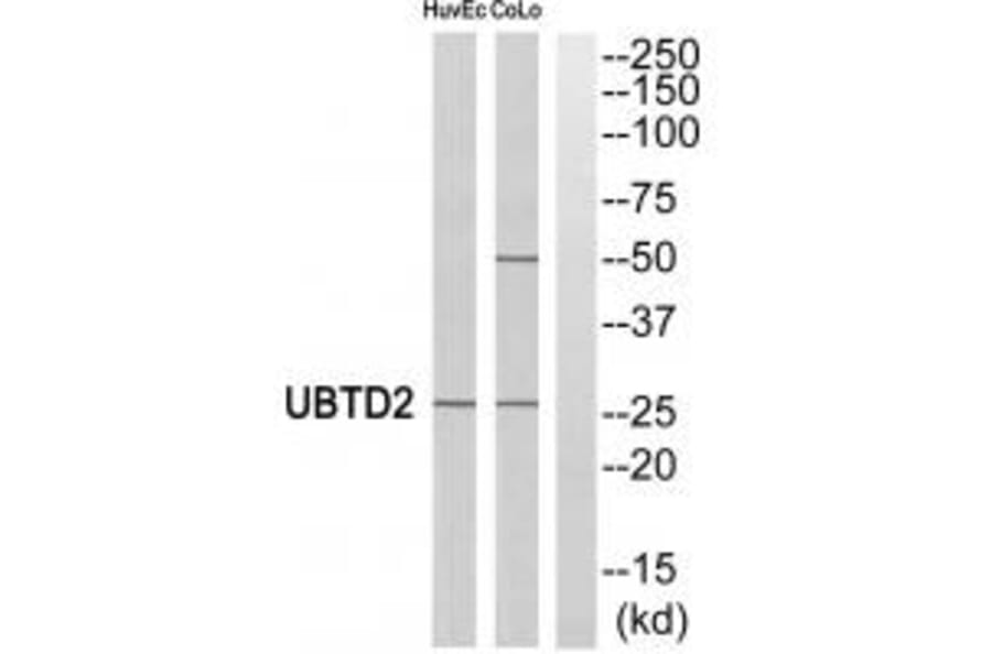Western blot - UBTD2 Antibody from Signalway Antibody (35127) - Antibodies.com