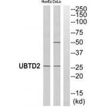 Western blot - UBTD2 Antibody from Signalway Antibody (35127) - Antibodies.com
