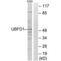 Western blot analysis of extracts from K562 cells, using UBFD1 antibody #35128.