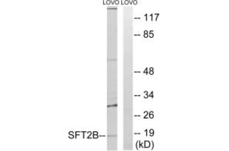 Western blot - SFT2B Antibody from Signalway Antibody (35139) - Antibodies.com