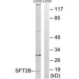 Western blot - SFT2B Antibody from Signalway Antibody (35139) - Antibodies.com