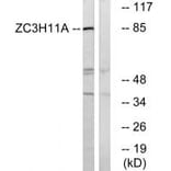 Western blot - ZC11A Antibody from Signalway Antibody (35152) - Antibodies.com