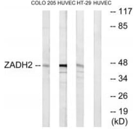 Western blot - ZADH2 Antibody from Signalway Antibody (35165) - Antibodies.com