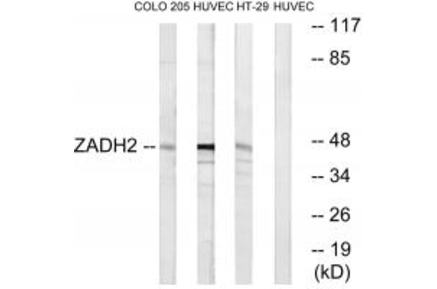 Western blot - ZADH2 Antibody from Signalway Antibody (35165) - Antibodies.com