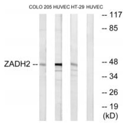 Western blot - ZADH2 Antibody from Signalway Antibody (35165) - Antibodies.com