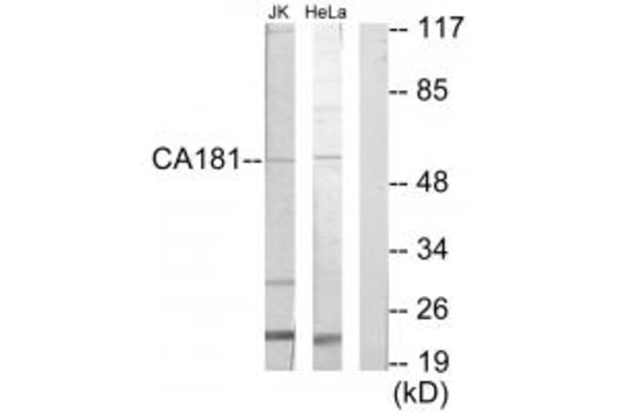 Western blot - CA181 Antibody from Signalway Antibody (35168) - Antibodies.com