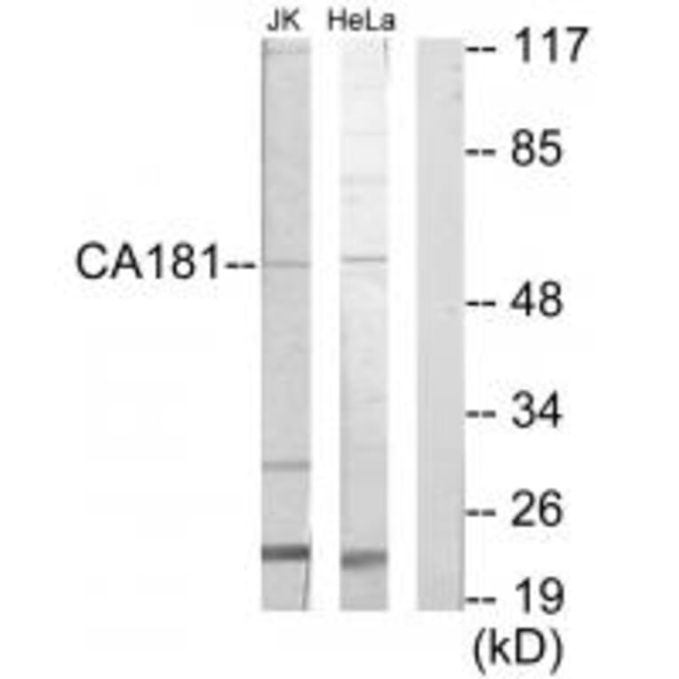 Western blot - CA181 Antibody from Signalway Antibody (35168) - Antibodies.com