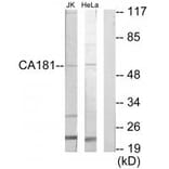 Western blot - CA181 Antibody from Signalway Antibody (35168) - Antibodies.com