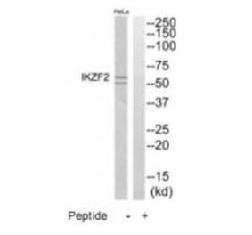 Western blot - IKZF2 Antibody from Signalway Antibody (35178) - Antibodies.com