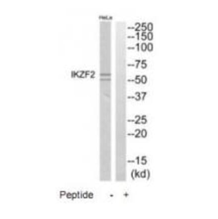 Western blot - IKZF2 Antibody from Signalway Antibody (35178) - Antibodies.com