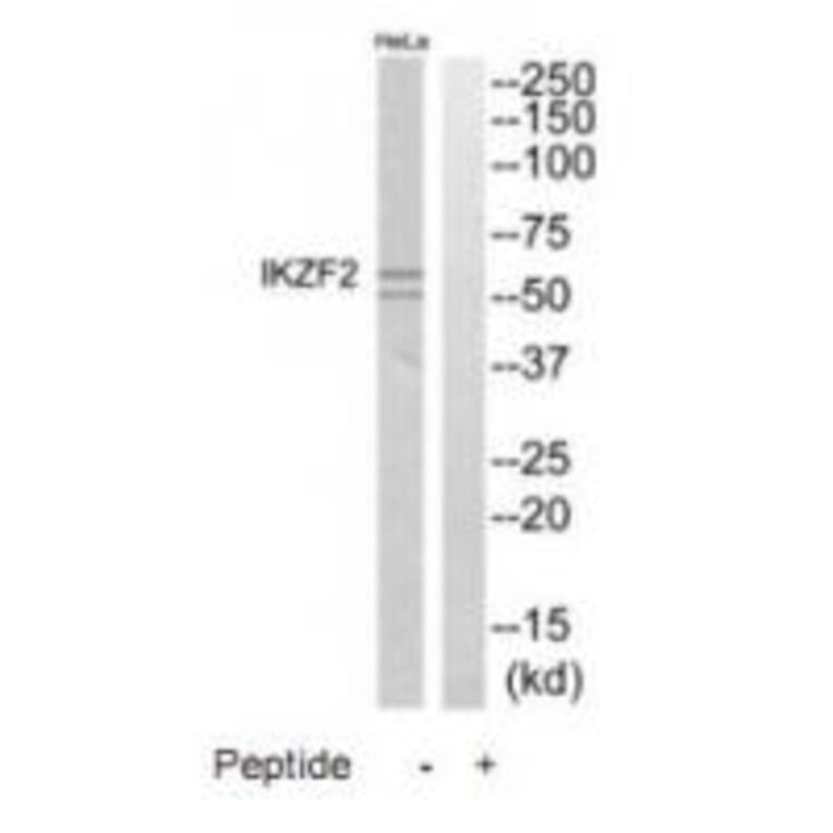 Western blot - IKZF2 Antibody from Signalway Antibody (35178) - Antibodies.com
