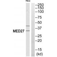 Western blot analysis of extracts from HeLa cells, using MED27 antibody #35183.