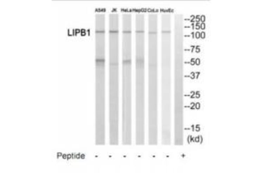 Western blot - LIPB1 Antibody from Signalway Antibody (35188) - Antibodies.com