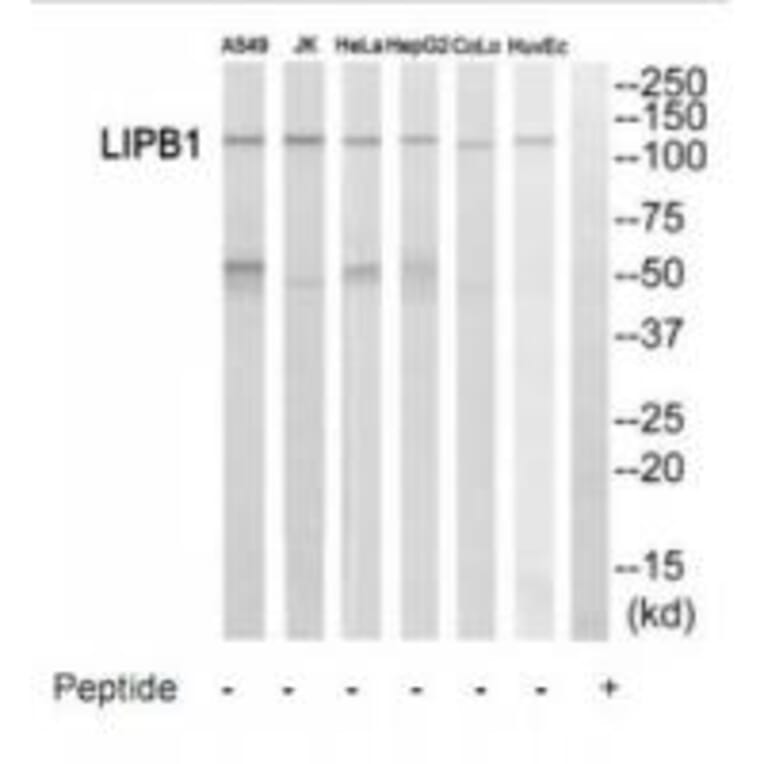 Western blot - LIPB1 Antibody from Signalway Antibody (35188) - Antibodies.com