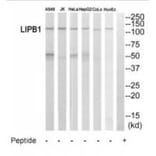 Western blot - LIPB1 Antibody from Signalway Antibody (35188) - Antibodies.com