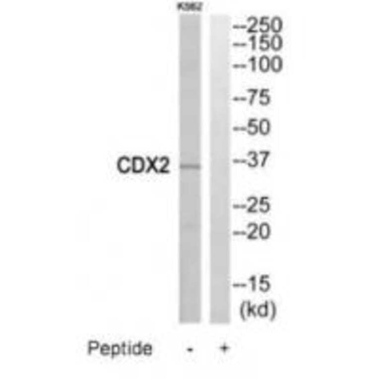 Western blot - CDX2 Antibody from Signalway Antibody (35198) - Antibodies.com
