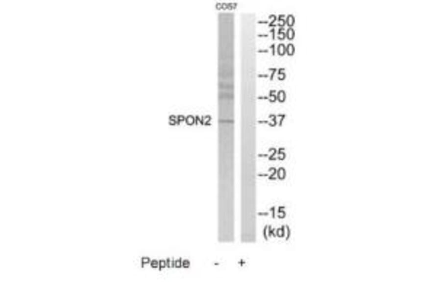 Western blot - SPON2 Antibody from Signalway Antibody (35200) - Antibodies.com