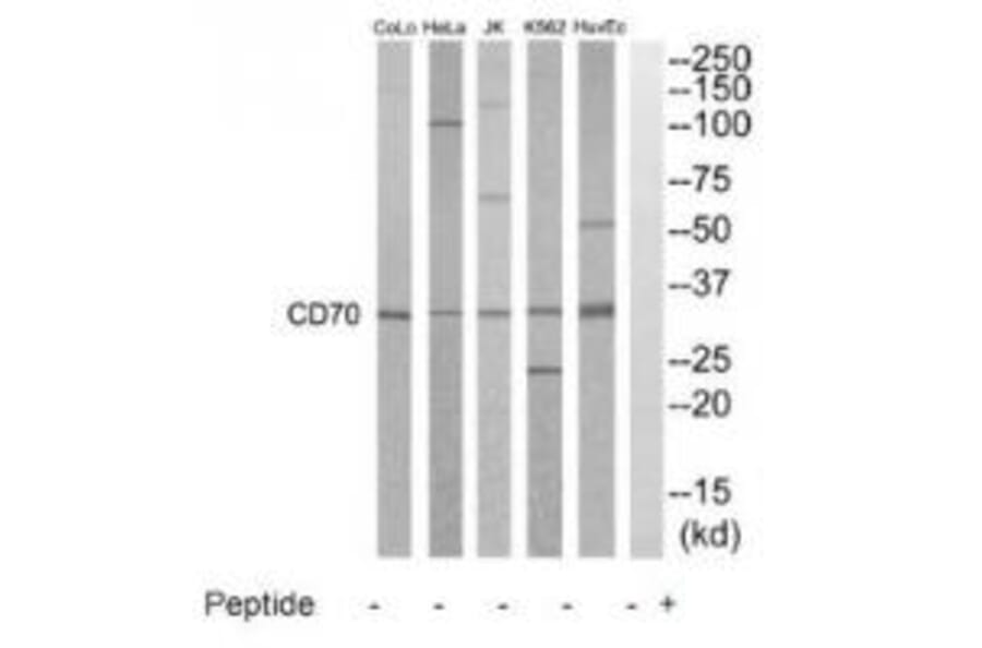 Western blot - CD70 Antibody from Signalway Antibody (35213) - Antibodies.com