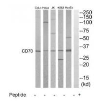 Western blot - CD70 Antibody from Signalway Antibody (35213) - Antibodies.com