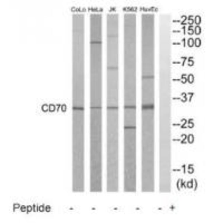Western blot - CD70 Antibody from Signalway Antibody (35213) - Antibodies.com