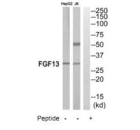 Western blot - FGF13 Antibody from Signalway Antibody (35216) - Antibodies.com
