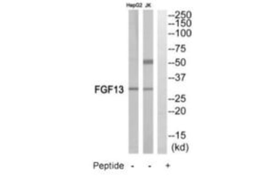 Western blot - FGF13 Antibody from Signalway Antibody (35216) - Antibodies.com