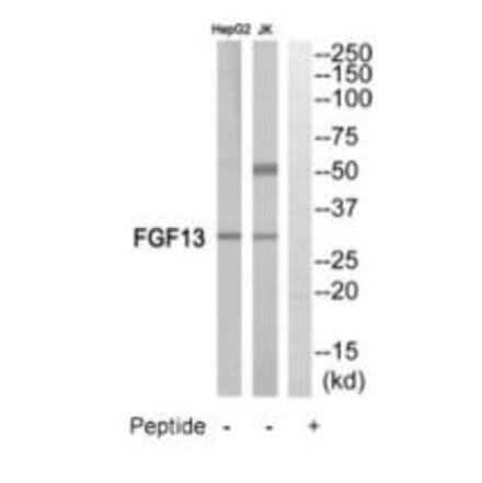 Western blot - FGF13 Antibody from Signalway Antibody (35216) - Antibodies.com