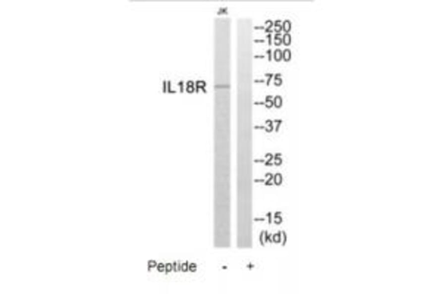 Western blot - IL18R Antibody from Signalway Antibody (35226) - Antibodies.com