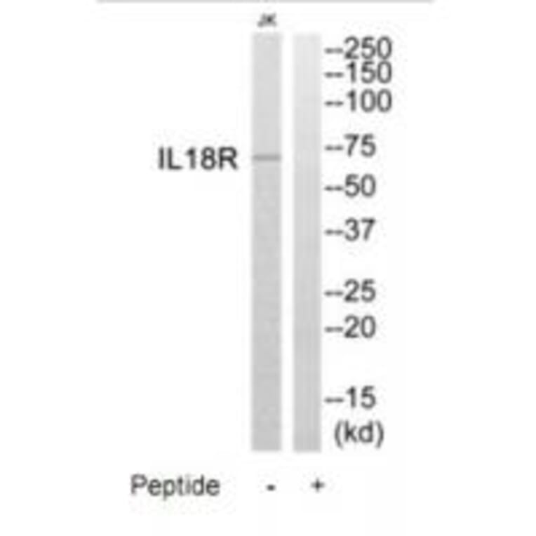 Western blot - IL18R Antibody from Signalway Antibody (35226) - Antibodies.com